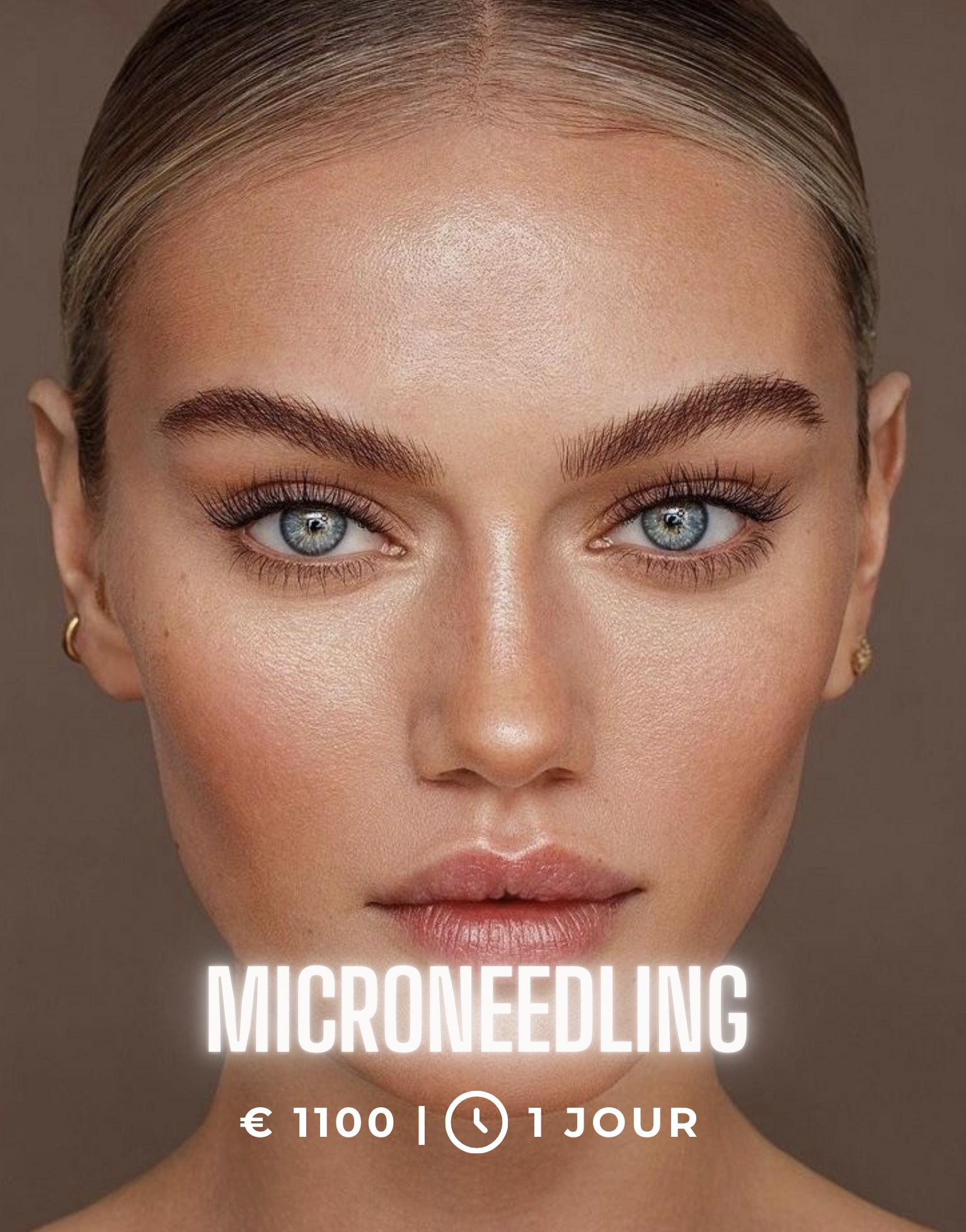 Formation Microneedling - Ika Beauty Ajaccio